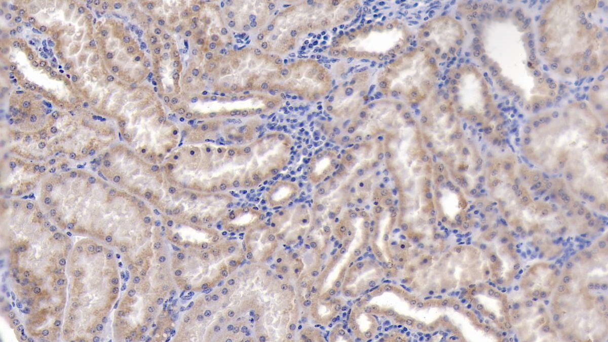 Polyclonal Antibody to Peroxiredoxin 3 (PRDX3)