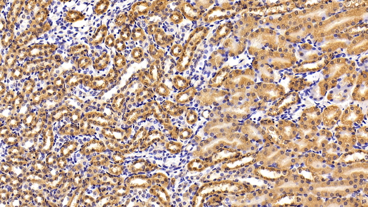 Polyclonal Antibody to Peroxiredoxin 5 (PRDX5)