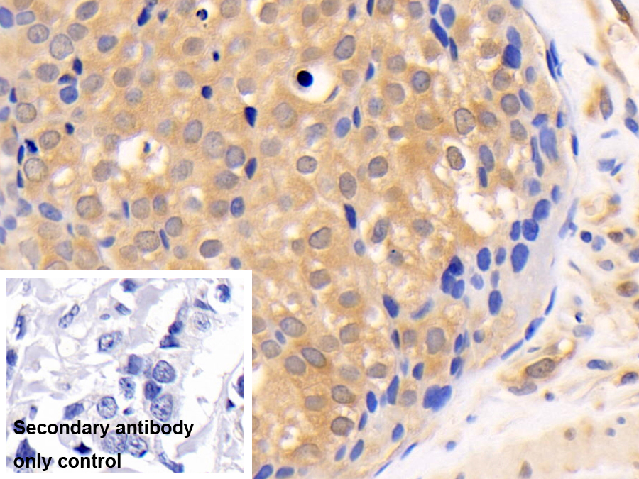Polyclonal Antibody to Phosphatase And Tensin Homolog (PTEN)