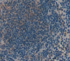 Polyclonal Antibody to Transient Receptor Potential Cation Channel Subfamily V, Member 2 (TRPV2)