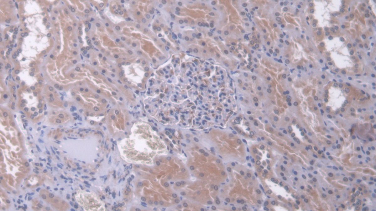 Polyclonal Antibody to Dual Specificity Phosphatase 6 (DUSP6)