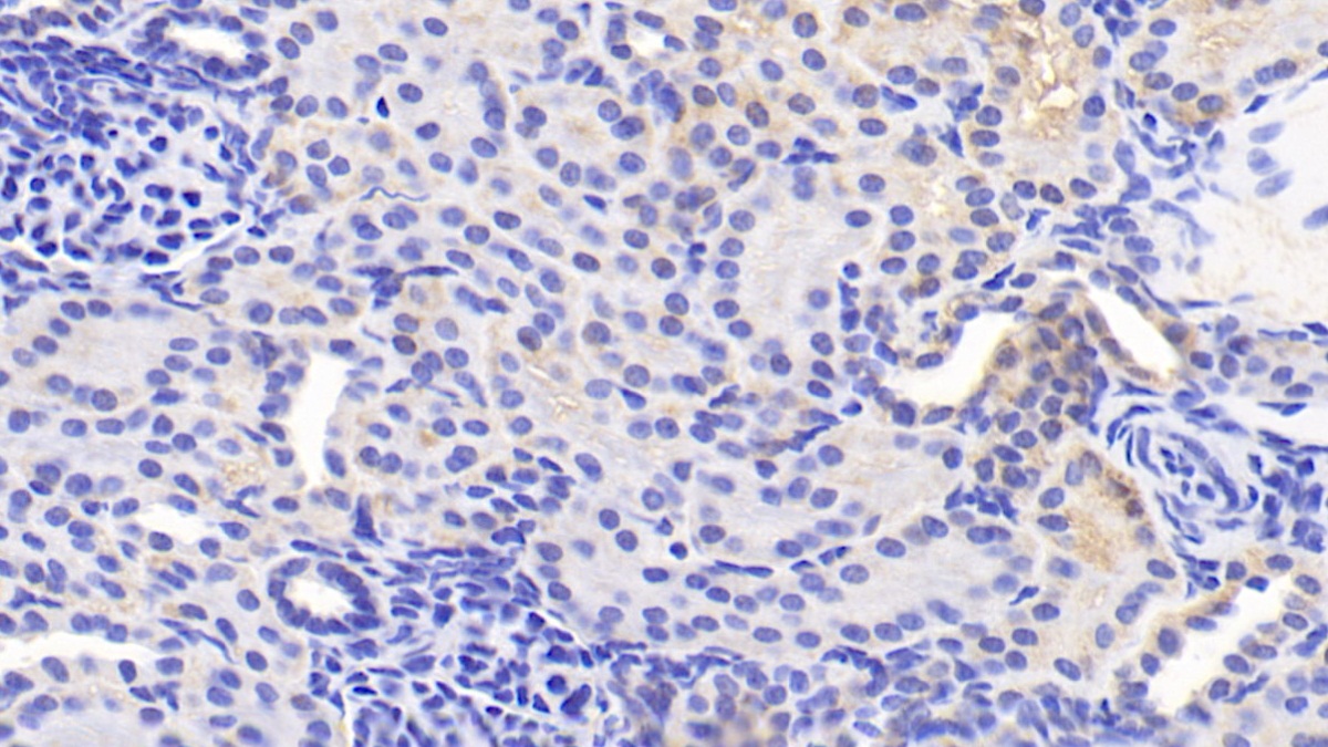 Polyclonal Antibody to Adaptor Related Protein Complex 2 Mu 1 (AP2m1)