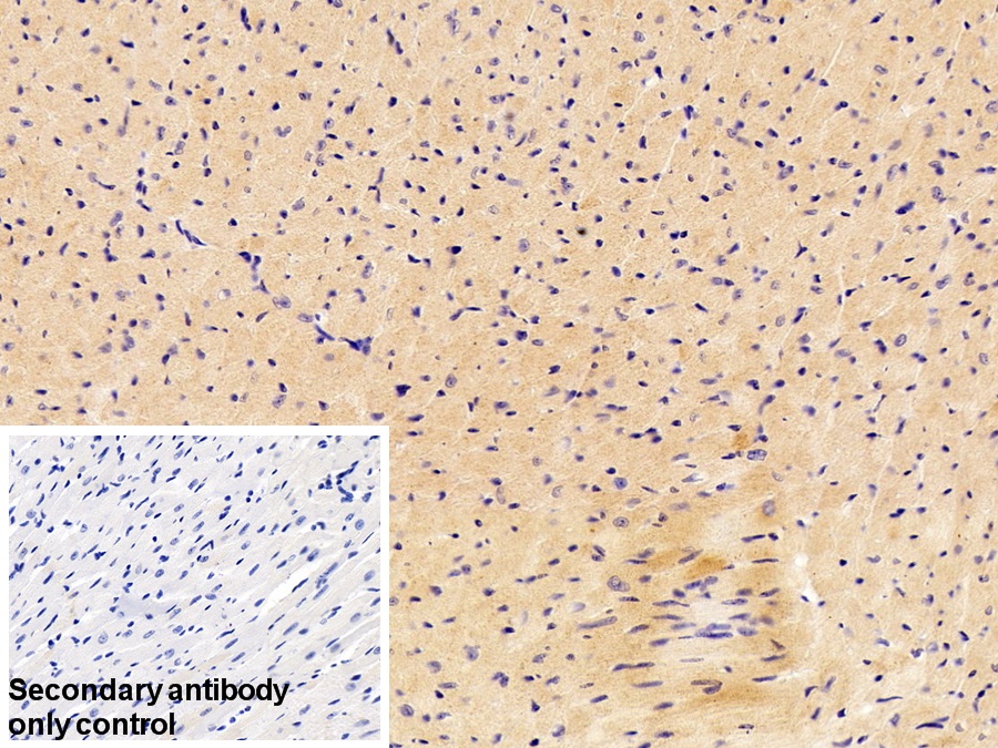 Polyclonal Antibody to p53 Responsive Gene 3 (PRG3)
