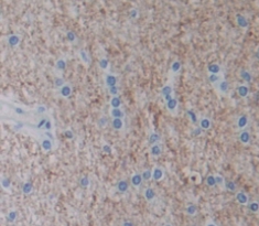 Polyclonal Antibody to Nephroblastoma Overexpressed Gene (NOV)