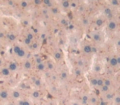 Polyclonal Antibody to Dipeptidyl Peptidase 9 (DPP9)