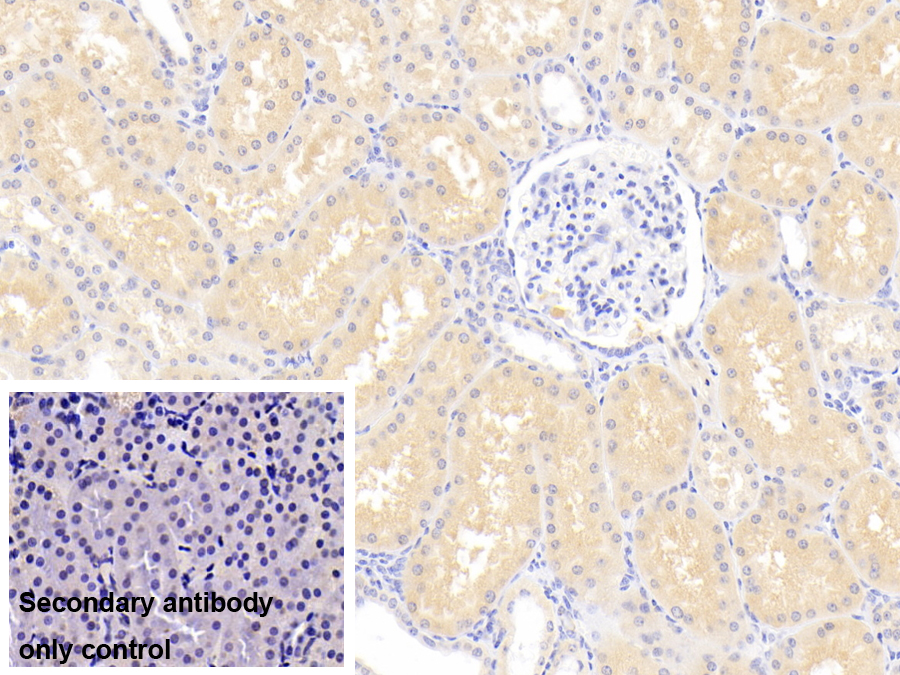Polyclonal Antibody to Lipocalin 12 (LCN12)