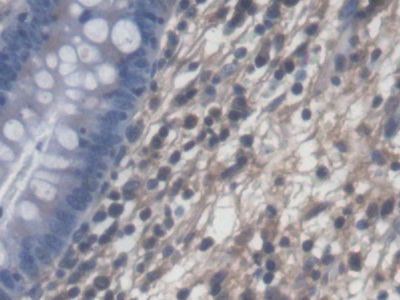 Polyclonal Antibody to Proteolipid Protein 2, Colonic Epithelium Enriched (PLP2)