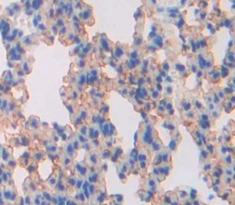 Polyclonal Antibody to Solute Carrier Family 30, Member 5 (SLC30A5)