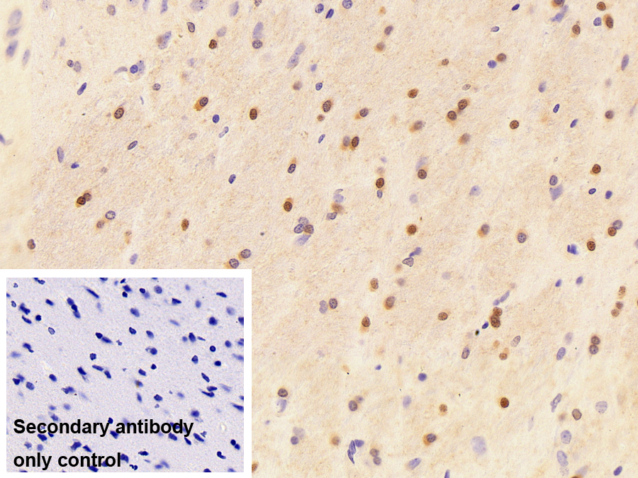 Polyclonal Antibody to RNA Binding Motif Protein 3 (RBM3)