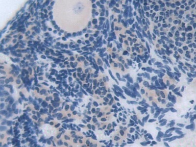 Polyclonal Antibody to TNF Receptor Associated Factor 6 (TRAF6)