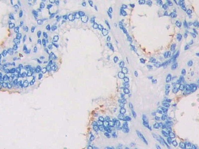 Polyclonal Antibody to Crk Like Protein (CRKL)