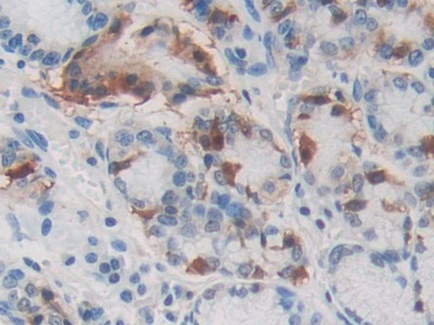 Polyclonal Antibody to Secretagogin (SCGN)