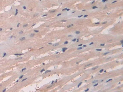 Polyclonal Antibody to Secretagogin (SCGN)