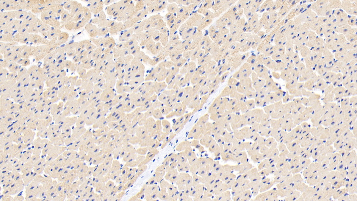 Polyclonal Antibody to Ankyrin Repeat Domain Protein 1 (ANKRD1)