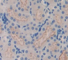 Polyclonal Antibody to Vasorin (VASN)