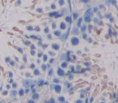 Polyclonal Antibody to UDP Glycosyltransferase 8 (UGT8)