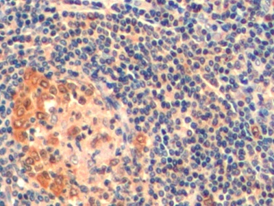 Polyclonal Antibody to Thymidylate Synthetase (TYMS)