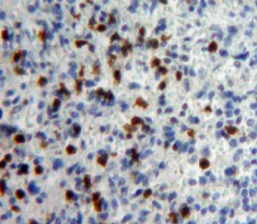 Polyclonal Antibody to Interferon Alpha 5 (IFNa5)