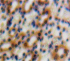 Polyclonal Antibody to Transforming Growth Factor Beta 1 Induced Transcript 1 (TGFb1I1)