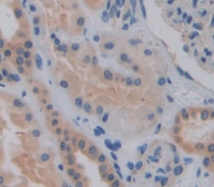 Polyclonal Antibody to Sulfatase 1 (SULF1)