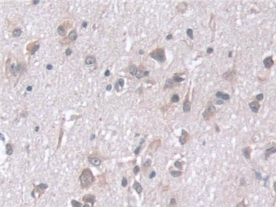 Polyclonal Antibody to Stress Induced Phosphoprotein 1 (STIP1)