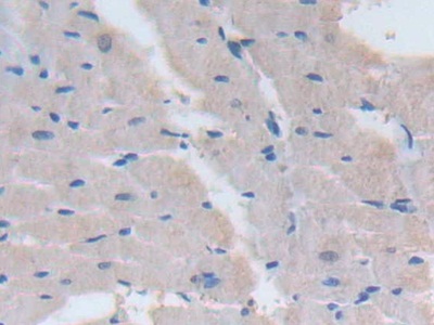 Polyclonal Antibody to Signal Transducing Adaptor Protein 1 (STAP1)