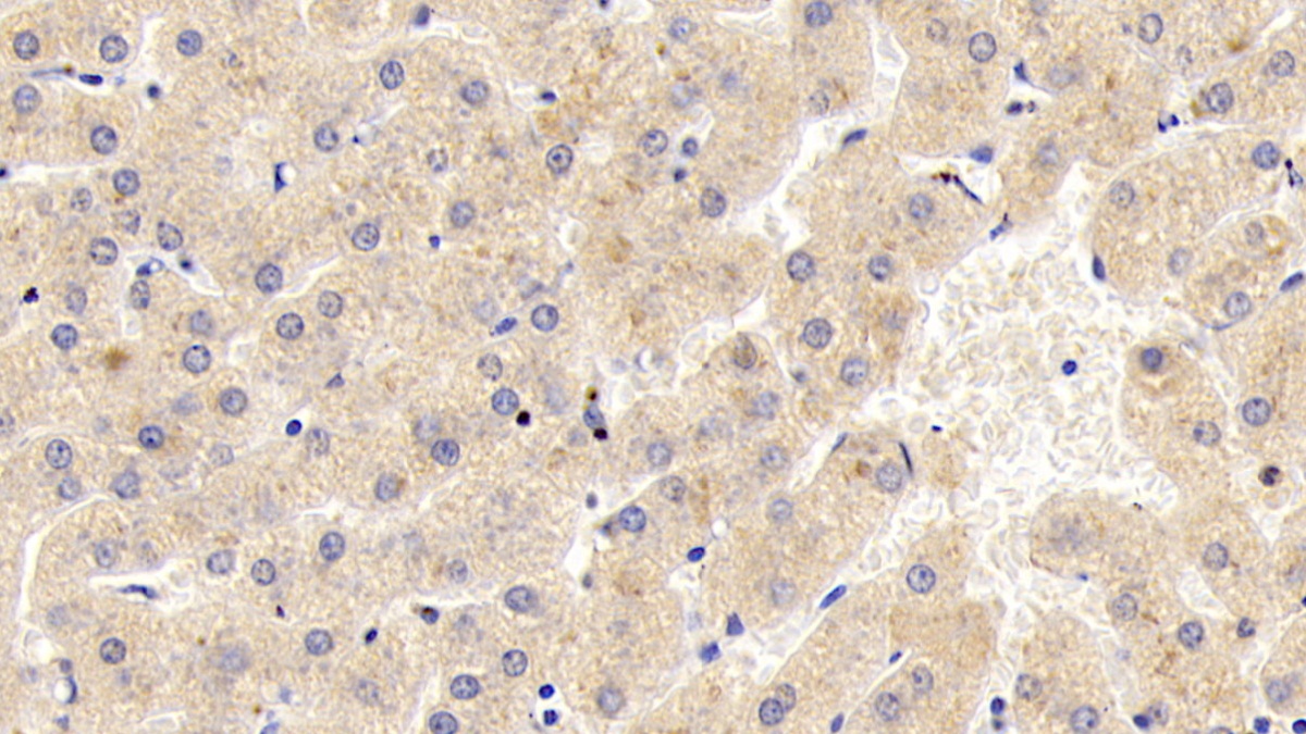 Polyclonal Antibody to Sorcin (SRI)