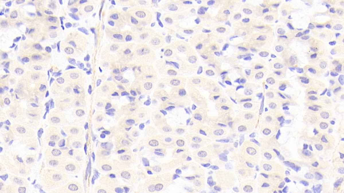 Polyclonal Antibody to Periplakin (PPL)