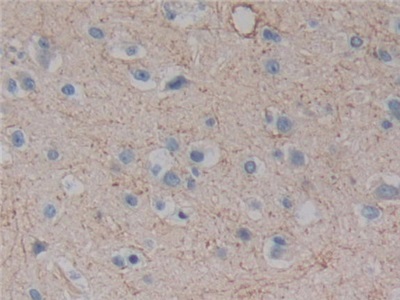 Polyclonal Antibody to Plexin A1 (PLXNA1)