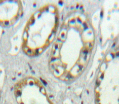 Polyclonal Antibody to Plasmalemma Vesicle Associated Protein (PLVAP)