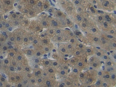 Polyclonal Antibody to Nicotinamide-N-Methyltransferase (NNMT)