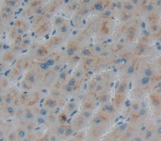 Polyclonal Antibody to N-Acetylgalactosaminidase Alpha (NAGa)