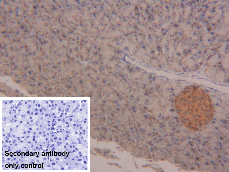 Polyclonal Antibody to N-Acetylgalactosaminidase Alpha (NAGa)