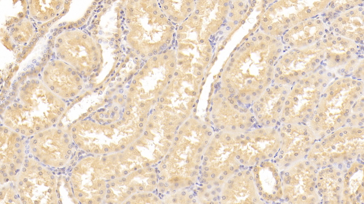 Polyclonal Antibody to Lectin, Mannose Binding 2 (LMAN2)