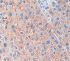 Polyclonal Antibody to Klotho Beta (KLb)