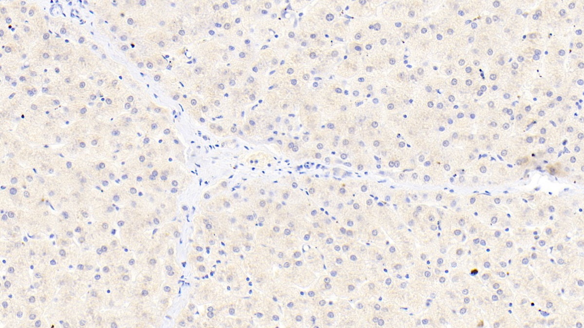 Polyclonal Antibody to Inter Alpha-Globulin Inhibitor H4 (ITIH4)