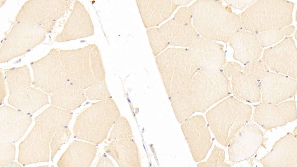Polyclonal Antibody to Inter Alpha-Globulin Inhibitor H3 (ITIH3)