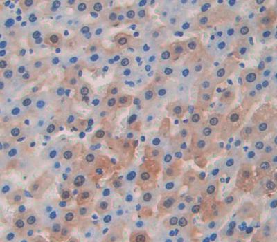 Polyclonal Antibody to Inter Alpha-Globulin Inhibitor H1 (ITIH1)