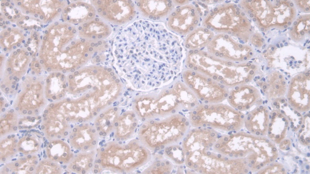 Polyclonal Antibody to Iduronidase Alpha L (IDUa)