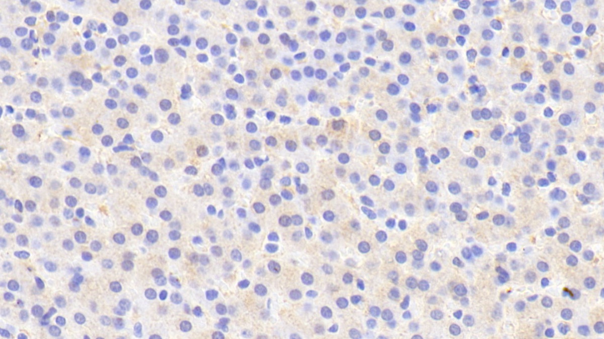 Polyclonal Antibody to Iduronate-2-Sulfatase (IDS)