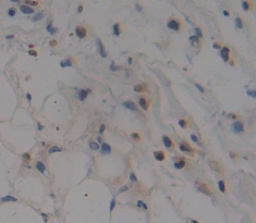 Polyclonal Antibody to Zinc Ribbon Domain Containing Protein 1 (ZNRD1)