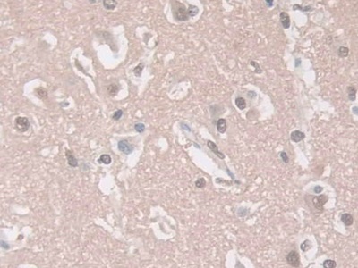 Polyclonal Antibody to Guanylate Cyclase 1 Beta 3 (GUCY1b3)