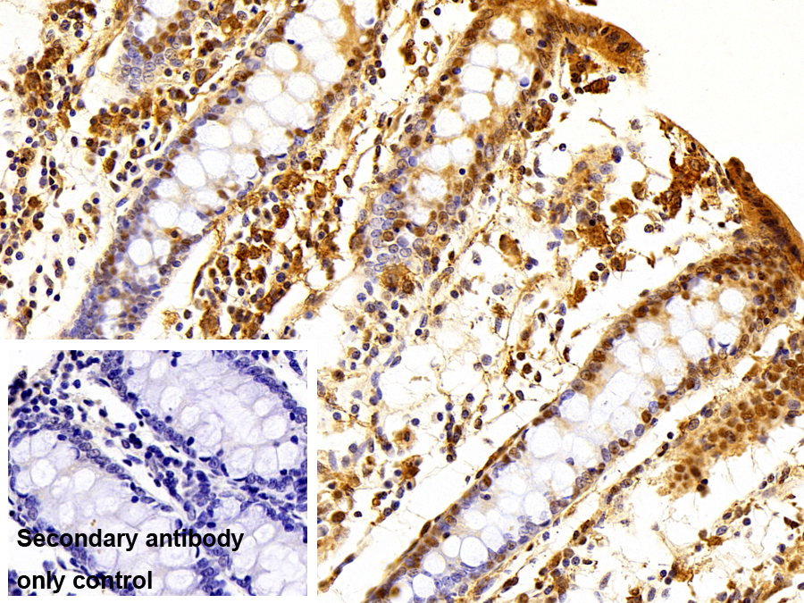Polyclonal Antibody to Fragile X Mental Retardation 1 (FMR1)