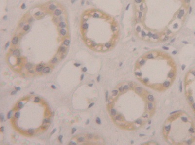 Polyclonal Antibody to D-Aspartate Oxidase (DDO)