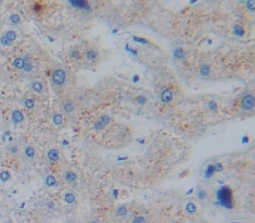 Polyclonal Antibody to Acetylcholinesterase Associated Protein (ACHAP)