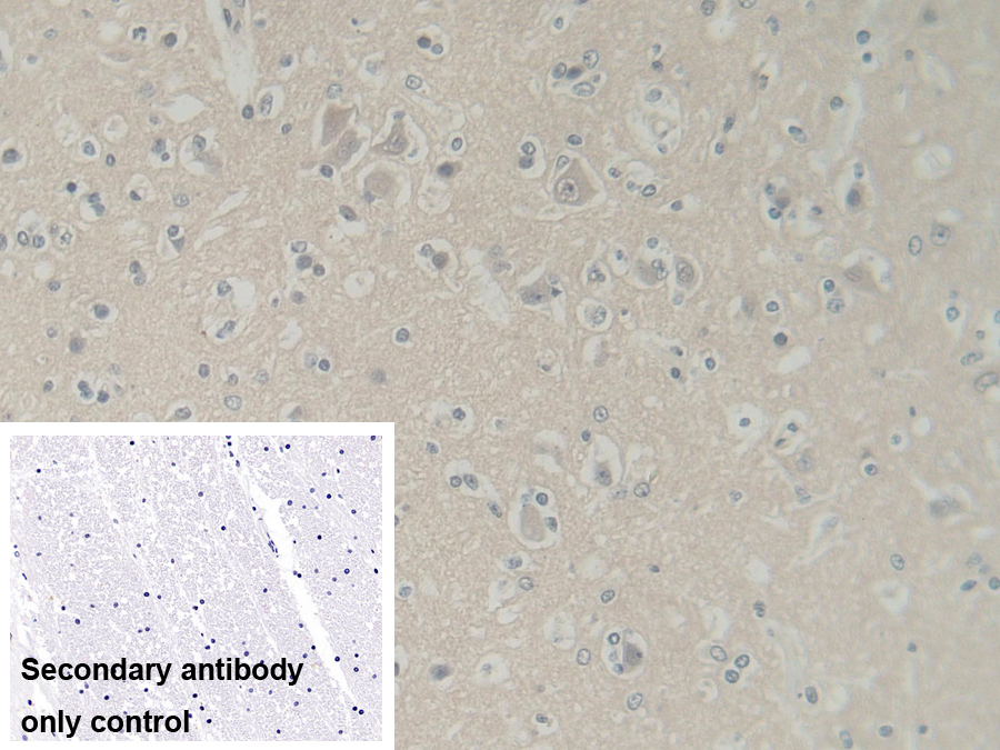 Polyclonal Antibody to Abl Interactor 1 (ABI1)