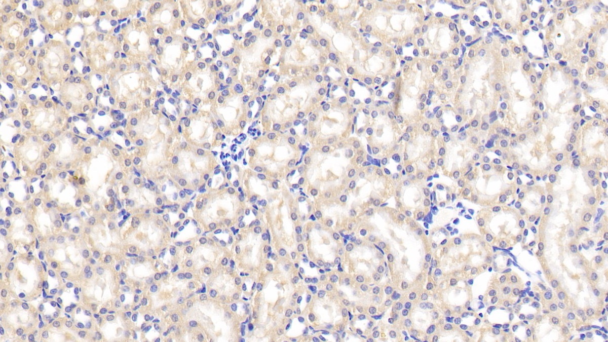 Polyclonal Antibody to Von Hippel Lindau Tumor Suppressor (vHL)