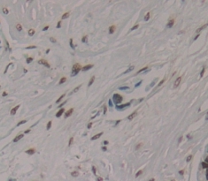 Polyclonal Antibody to AF4/FMR2 Family, Member 1 (AFF1)
