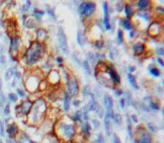 Polyclonal Antibody to V-Set Domain Containing T-Cell Activation Inhibitor 1 (VTCN1)