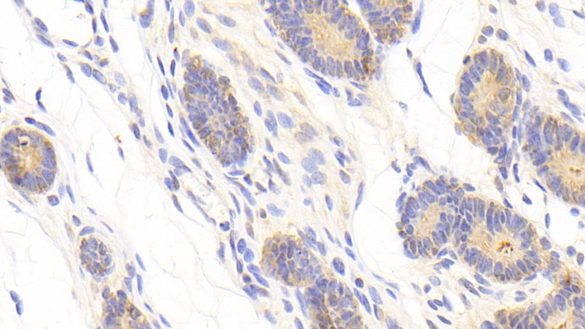 Polyclonal Antibody to A Disintegrin And Metalloprotease 12 (ADAM12)